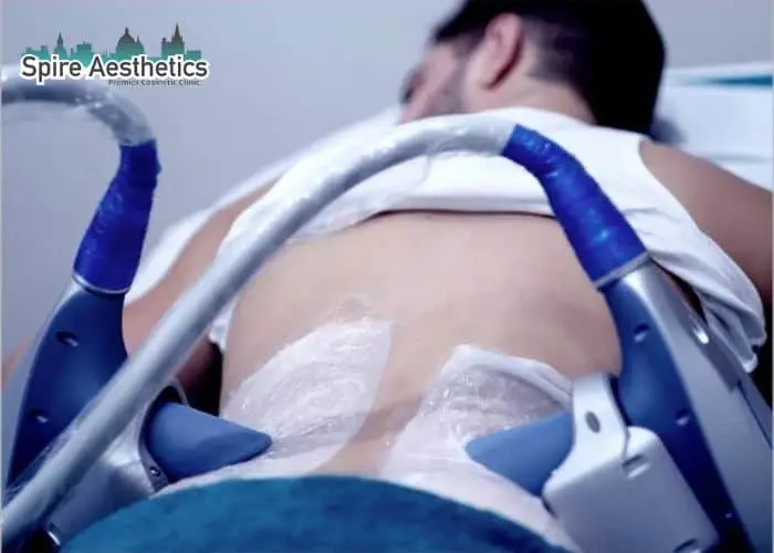 Man having fat freezing treatment done on love handles before a competitions Brierley Hill to create a sculpted look.